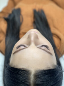 Szkolenie peeling chemiczny