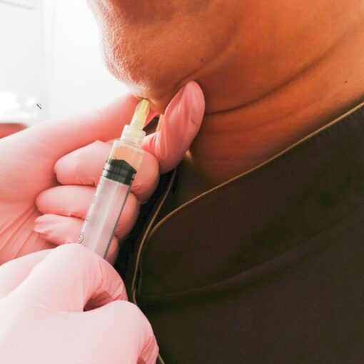 lipoliza iniekcyjna Lilo Beauty